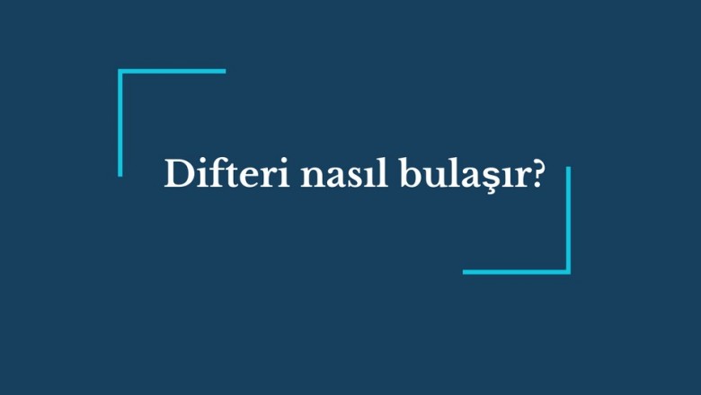 Difteri Kuşpalazı hastalığı nedir belirtileri nelerdir Difteri