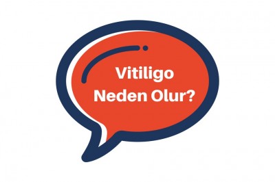 Vitiligo Hastalığı Nedir Bulaşıcı Mıdır? Vitiligonun Belirtileri ve Tedavisi