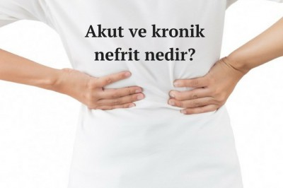 Nefrit hastalığı (böbrek iltihabı) nedir belirtileri nelerdir? Nefrit çeşitleri ve tedavisi